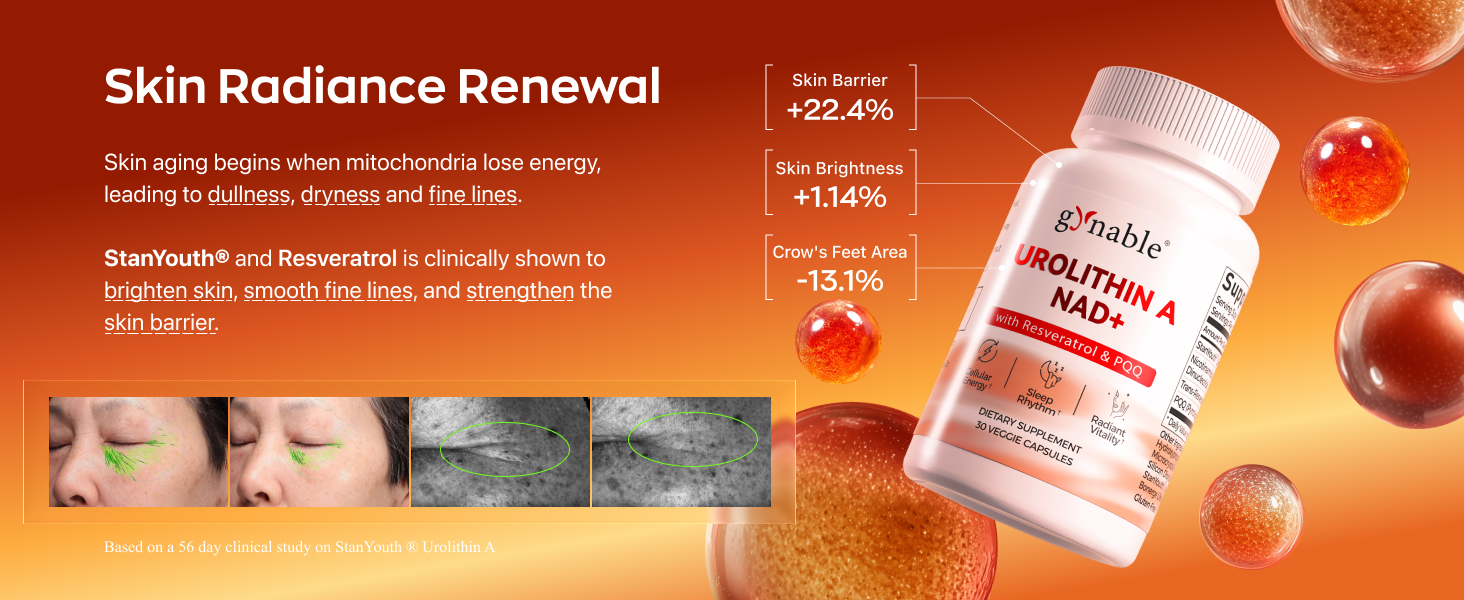 Gynable Urolithin A Supplement with NMN & PQQ, Cellular Energy