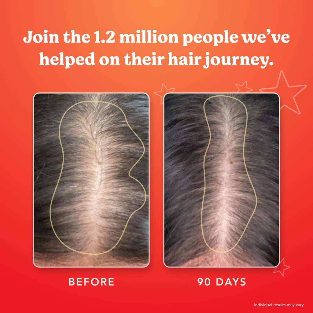 hairtamin-mom-vegan-prenatal-postnatal-m-6.jpg