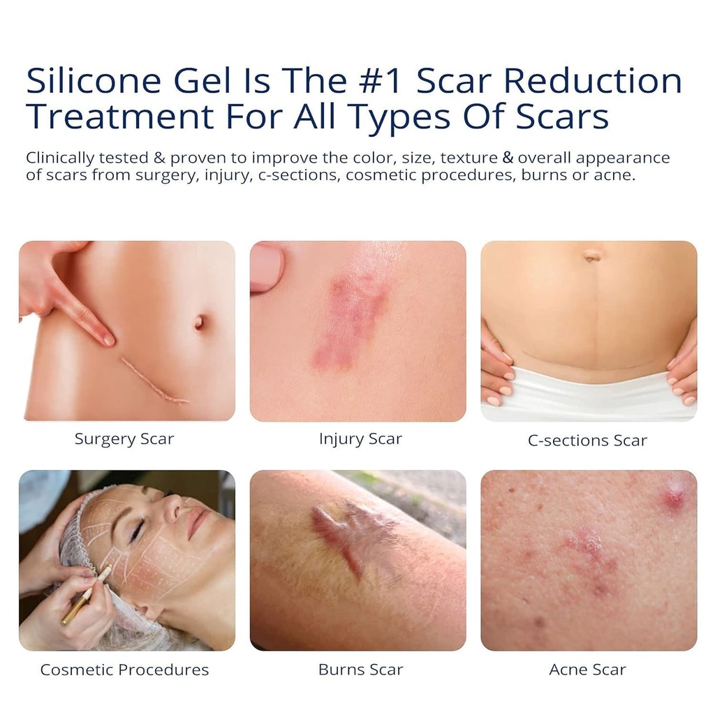 100-silicone-scar-gel-2-pack-2-x-1-06oz--718ZKka8eML.jpg