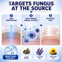 toenail-fungus-treatment-25-undecylenic--711stlAci0L.jpg