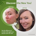 exposed-skin-care-probiotic-supplement-c-3.jpg