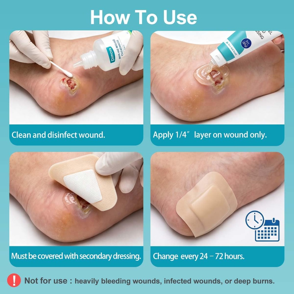 dimora-2-packs-6oz-hydrogel-first-aid-oi-61-BBc2eZQL.jpg
