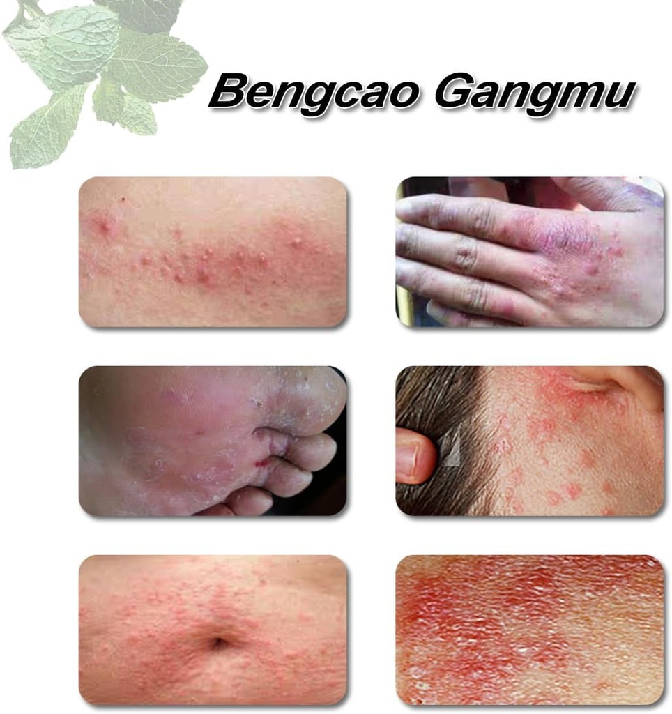 dermatitis-inflammation-and-rashes-body--5.jpg