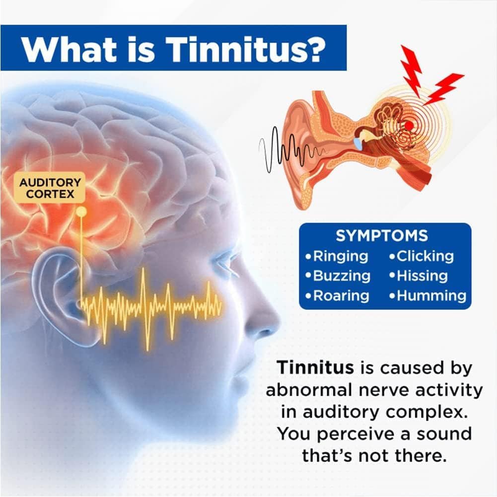 acupeace-tinnitus-relief-device-acupeace-3.jpg