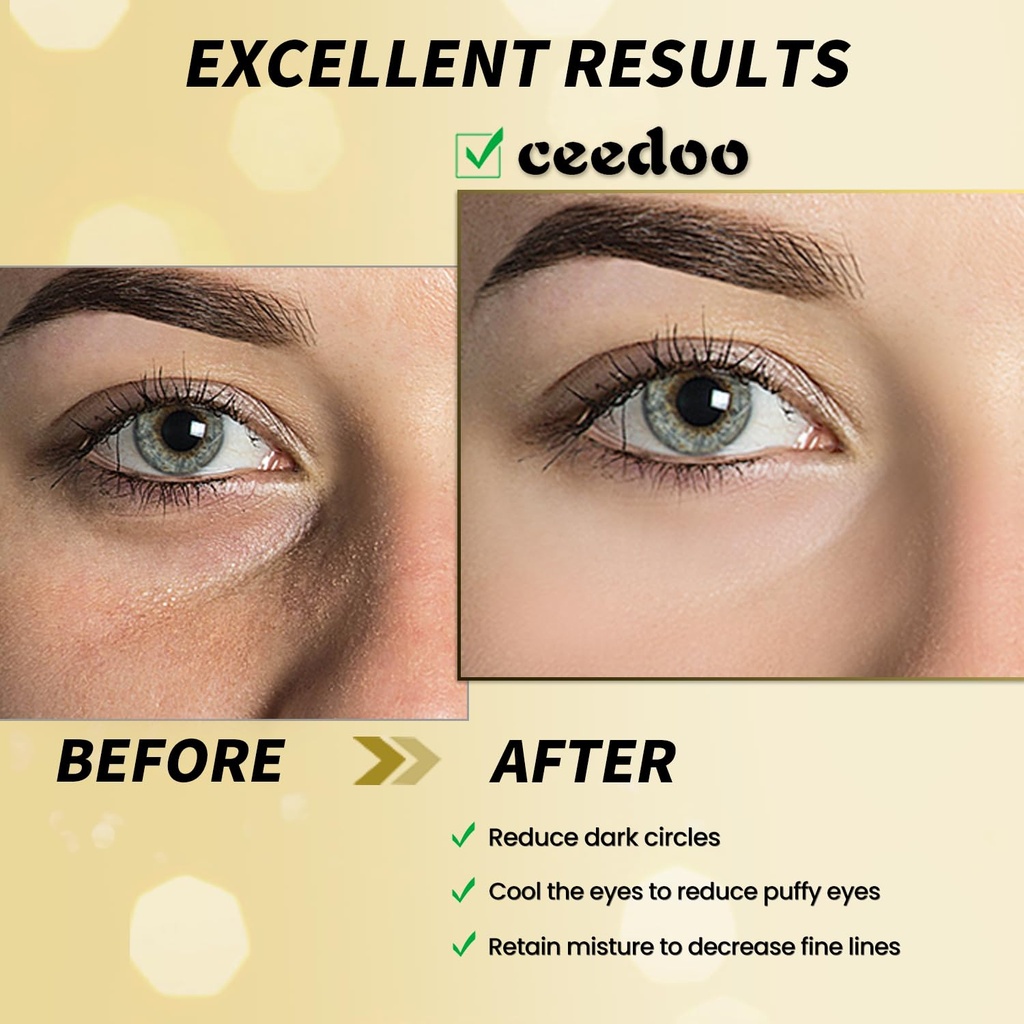 under-eye-patches---24-pairs-gold-under--3.jpg