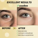 under-eye-patches---24-pairs-gold-under--3.jpg