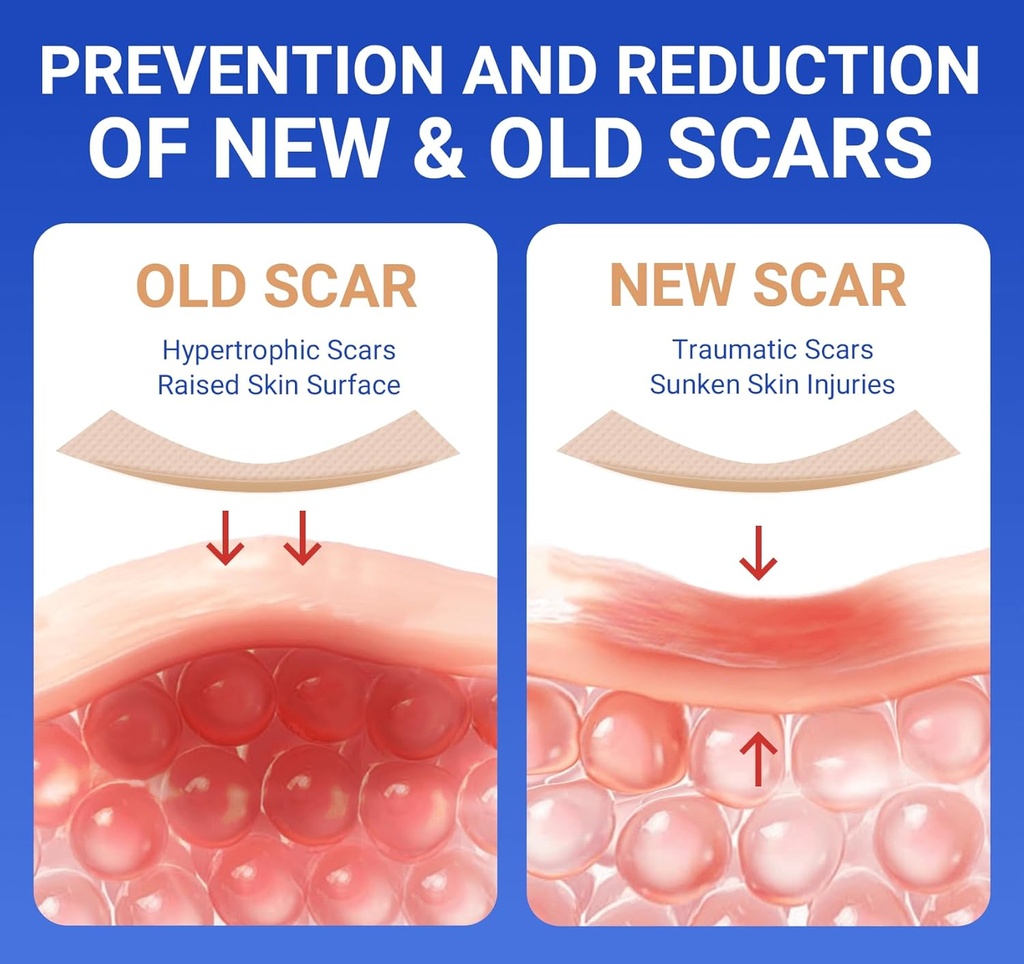 silicone-scar-sheets-surgical-tape-16x12-4.jpg