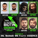 beard-growth-kit-w-2x-biotin-beard-balm--3.jpg