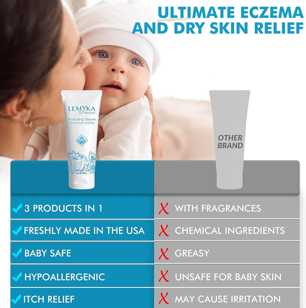 baby-eczema-cream-for-dry-itchy-skin-soo-5.jpg