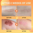 abera-scar-removal-cream-for-women-and-m-4.jpg