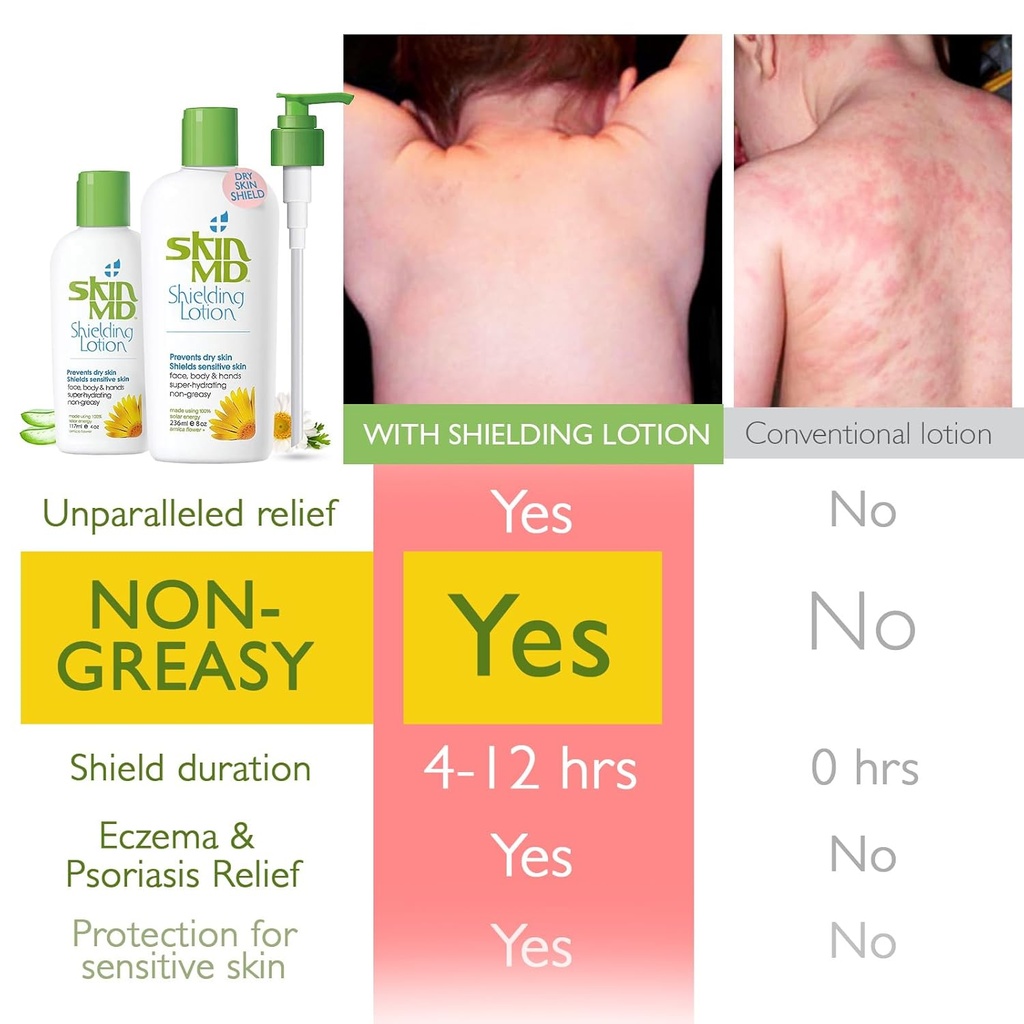 skin-md-shielding-lotion---hydrating-bod-2.jpg