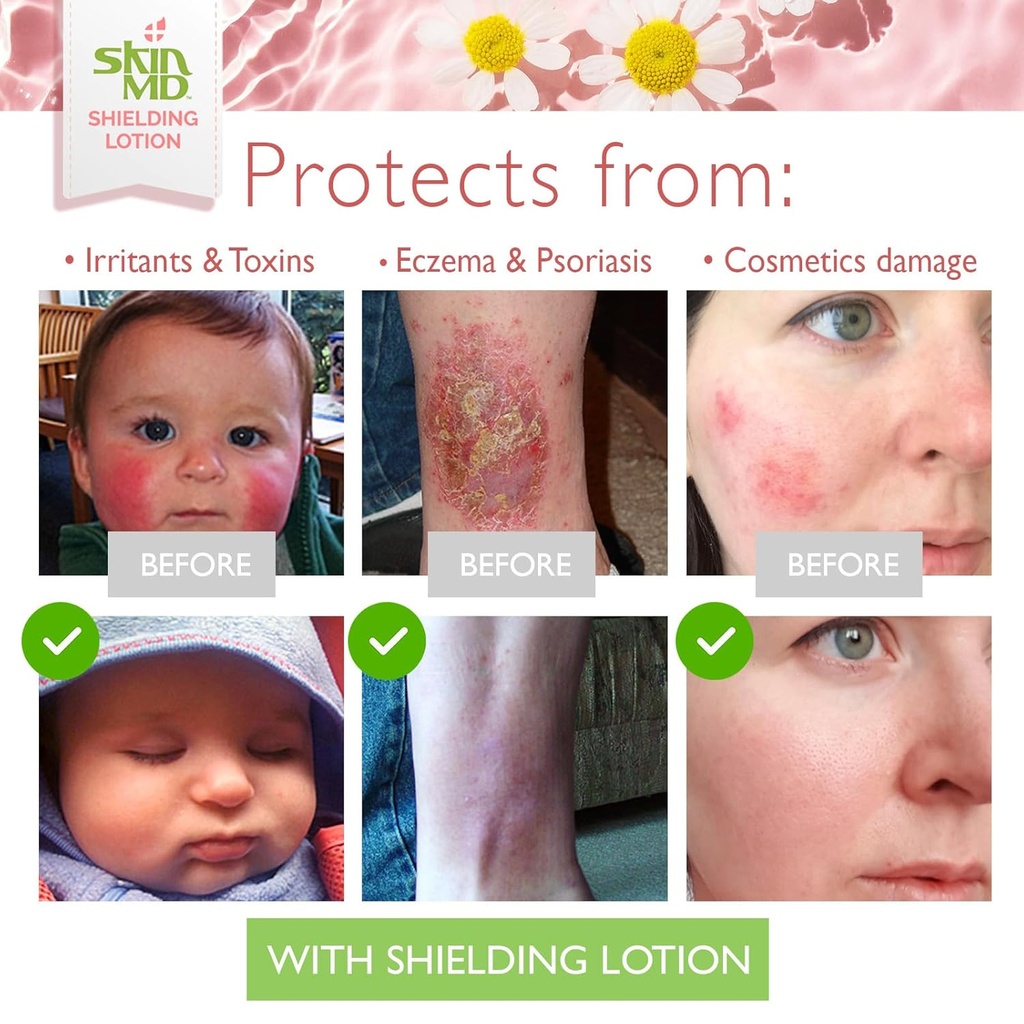 skin-md-shielding-lotion---hydrating-bod-5.jpg
