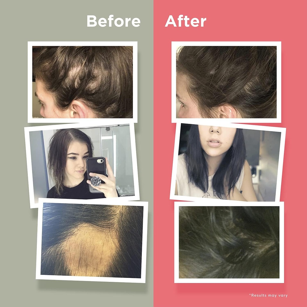 hairanew-hair-growth-vitamins-for-thicke-5.jpg