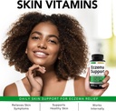 greenford-eczema-treatment-support-for-n-3.jpg