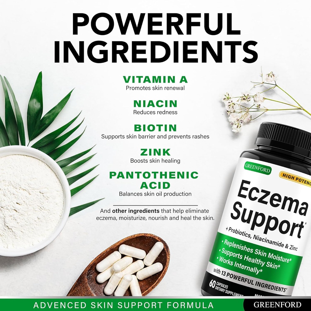 greenford-eczema-treatment-support-for-n-4.jpg
