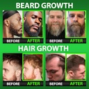 beard-growth-kit-wgrow-11-in-1-hair-grow-5.jpg