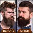 beard-oil120ml425floz-oil-promote-large--6.jpg