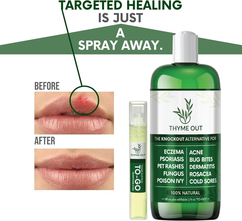all-natural-eczema-treatment--psoriasis--6.jpg