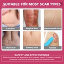 silicone-scar-sheetssilicone-scar-tape-f-2.jpg