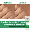 2-colloidal-oatmeal-eczema-lotion---soot-2.jpg