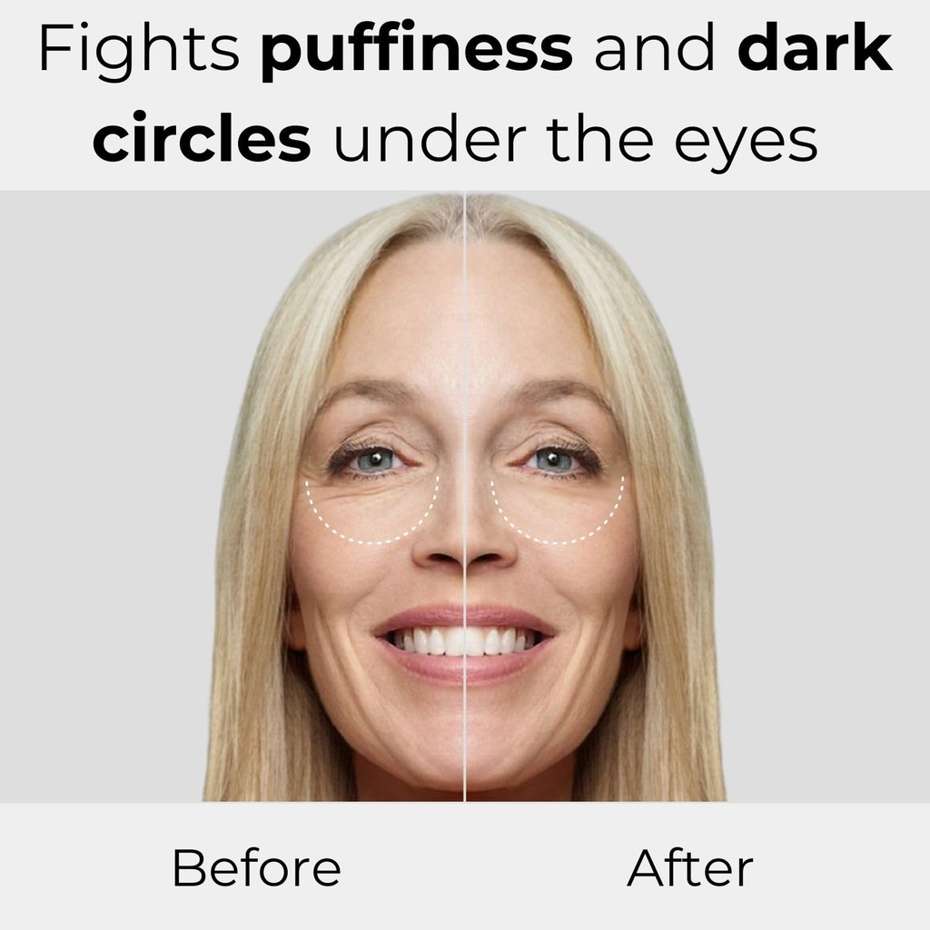 m-asam-magic-care-perfect-eye-serum---ey-3.jpg