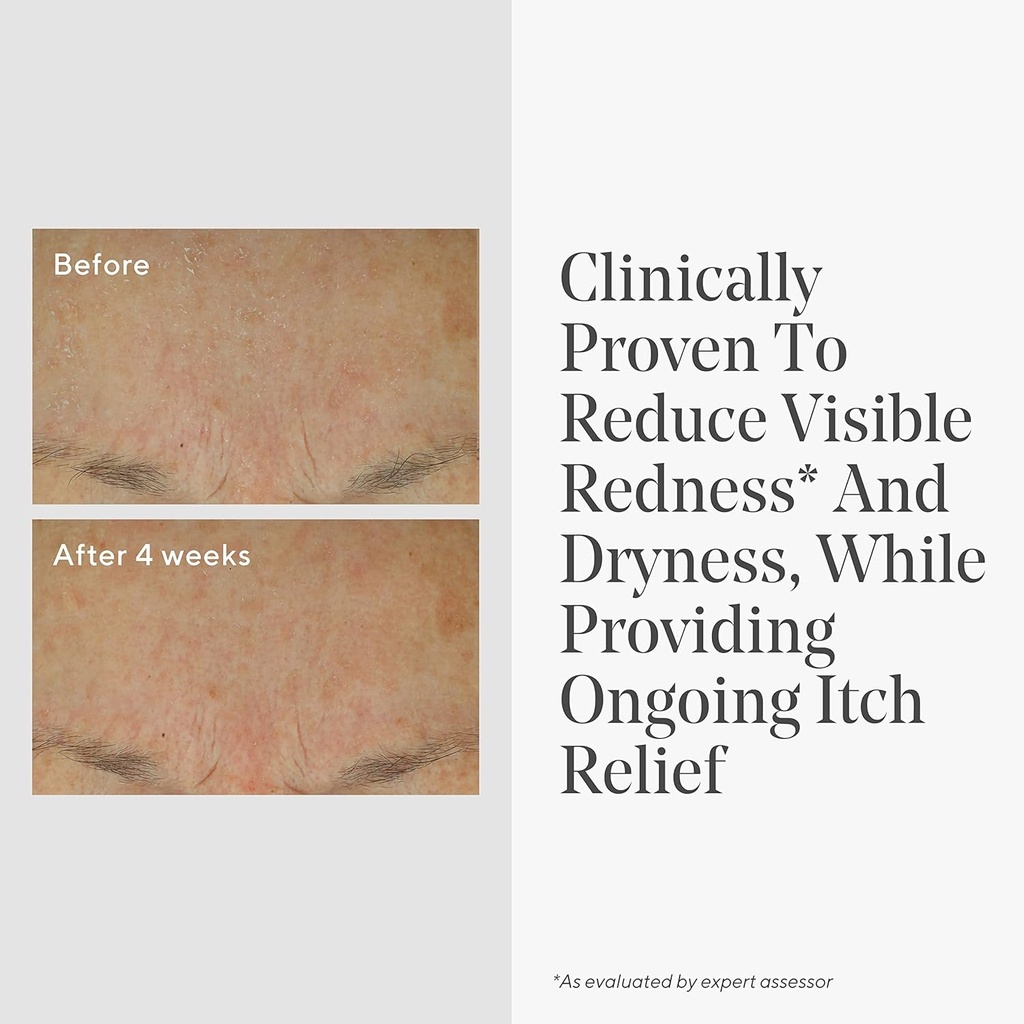 murad-eczema-control-daily-defense-collo-3.jpg