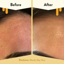 eczema-honey-15-vitamin-c-ferulic-acid-s-4.jpg
