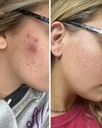 bella-grace-elixir-collagen-peptides-sup-5.jpg