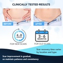 silicone-scar-gel-silicone-gel-for-scars-3.jpg
